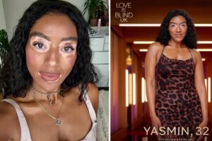 La représentation du vitiligo de Yasmin dans Love is Blind pourrait changer des vies